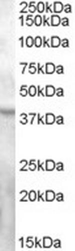 GPR119 Polyclonal Antibody