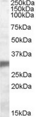 PHD3 Polyclonal Antibody