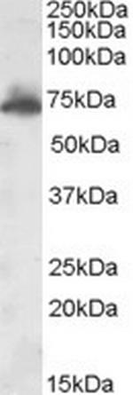 AKAP10 Antibody in Western Blot (WB)