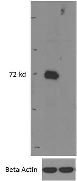 IRAK-M Polyclonal Antibody