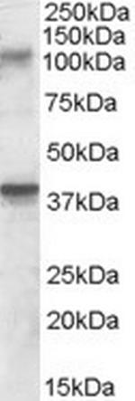 GluR7 Polyclonal Antibody