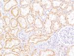 MRP5 Antibody in Immunohistochemistry (Paraffin) (IHC (P))
