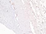 MRP5 Antibody in Immunohistochemistry (Paraffin) (IHC (P))