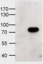 ABCD1 Polyclonal Antibody