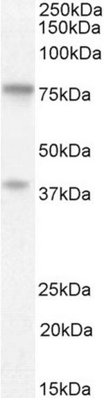ZRANB1 Polyclonal Antibody