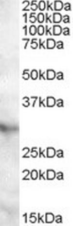 APOA1BP Polyclonal Antibody