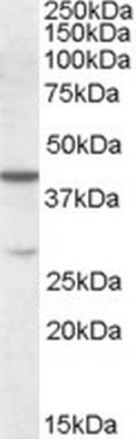 CBX8 Polyclonal Antibody