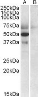 Apolipoprotein L4 Antibody in Western Blot (WB)