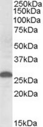 Apolipoprotein M Antibody in Western Blot (WB)