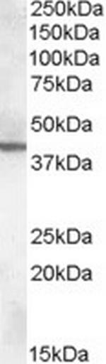 ABHD12 Polyclonal Antibody