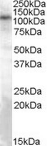 TRPC4 Antibody in Western Blot (WB)