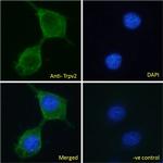 TRPV2 Polyclonal Antibody