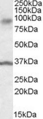 ANKK1 Antibody in Western Blot (WB)