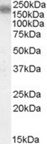 LRP4 Antibody in Western Blot (WB)
