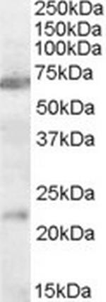 CHRNA4 Polyclonal Antibody