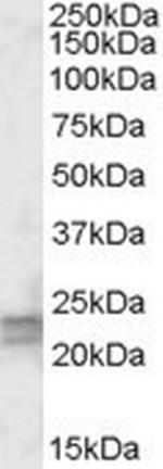 ARL4D Polyclonal Antibody