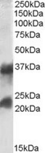 Clathrin Light Chain Antibody in Western Blot (WB)