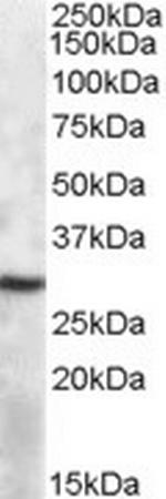 APOBEC1 Polyclonal Antibody