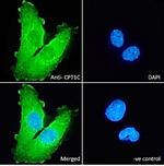 CPT1C Polyclonal Antibody