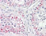 CPT1C Antibody in Immunohistochemistry (Paraffin) (IHC (P))