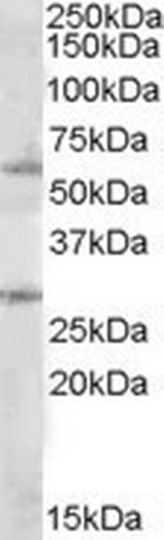 SOCS7 Polyclonal Antibody