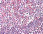 Septin 2 Antibody in Immunohistochemistry (Paraffin) (IHC (P))