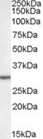 DPM1 Polyclonal Antibody