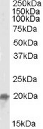 NCE2 Antibody in Western Blot (WB)