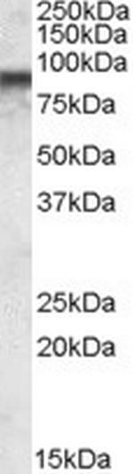 COG7 Antibody in Western Blot (WB)