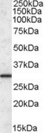 ERP29 Polyclonal Antibody