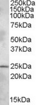 PHR1 Polyclonal Antibody