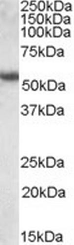 Cytokeratin 13 Antibody in Western Blot (WB)