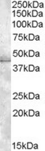 MBNL1 Polyclonal Antibody