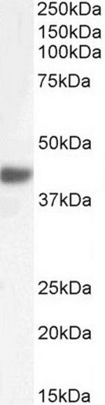 FBXO32 Polyclonal Antibody