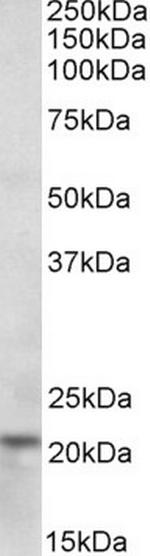 Ferritin Heavy Chain Antibody in Western Blot (WB)