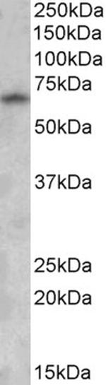 GAD67 Antibody in Western Blot (WB)