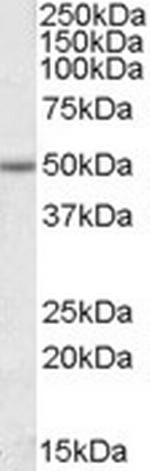 EVL Polyclonal Antibody