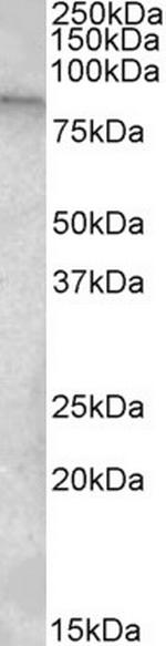 TRPC4AP Polyclonal Antibody
