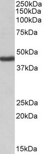 Kir1.1 (KCNJ1) Polyclonal Antibody