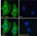 ITM2B Polyclonal Antibody