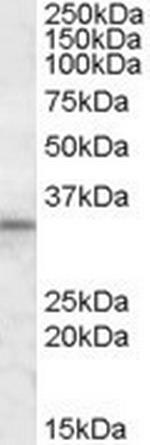 HAX1 Polyclonal Antibody