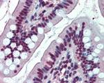 EWSR1 Antibody in Immunohistochemistry (Paraffin) (IHC (P))