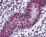 EWSR1 Antibody in Immunohistochemistry (Paraffin) (IHC (P))