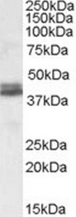 Nudel Polyclonal Antibody
