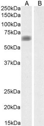 SLC47A1 Antibody in Western Blot (WB)