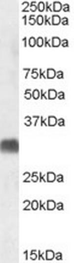 SRD5A2 Polyclonal Antibody