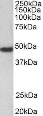 PAR1 Antibody in Western Blot (WB)