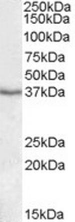 PON1 Polyclonal Antibody