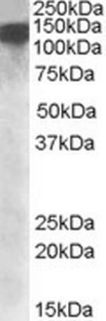 DHX9 Polyclonal Antibody