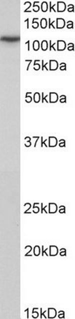 PSD-95 Polyclonal Antibody